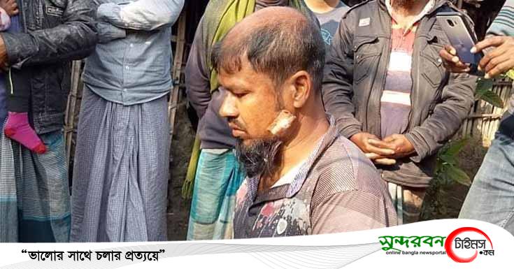 সুন্দরবনের বাঘের সাথে লড়াই করে জীবন নিয়ে ফিরে এলো আবু হায়াত ঢালী